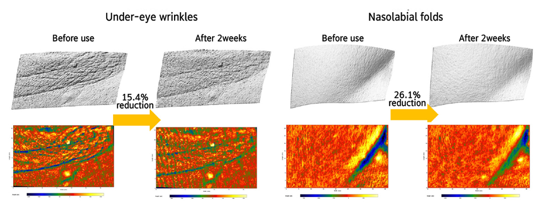 Clinical (human application) test result screen confirming the skin wrinkle-improvement effect of a pure retinol 0.1% product, conducted at an Amorepacific lab