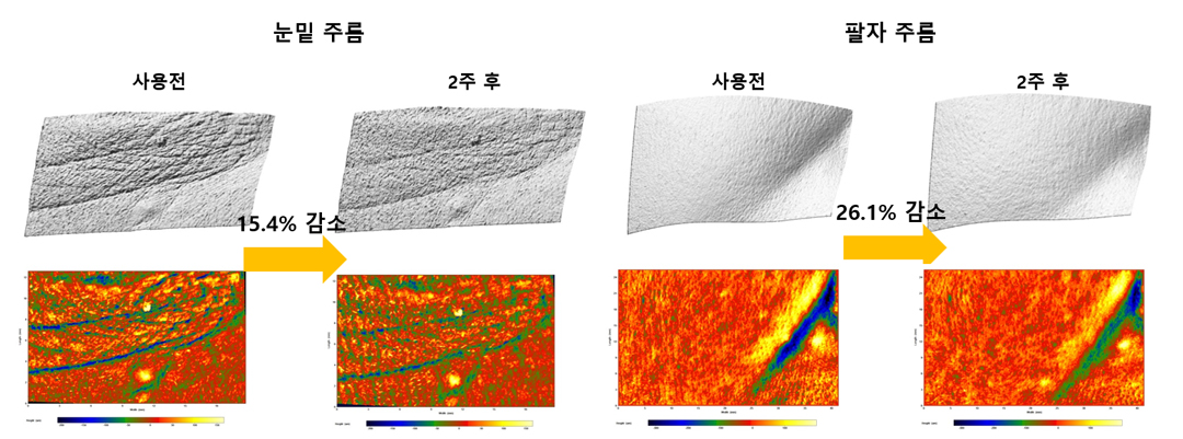 아모레퍼시픽 연구실에서 진행된 순수 레티놀 0.1% 배합 제품의 피부 주름 개선 효과 확인 인체적용 시험 결과 화면