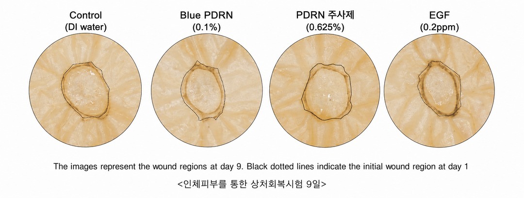 일정한 길이의 DNA 조각인 PDRN 성분이 손상된 피부 환경에서 피부의 자가 회복을 돕는 작용 메커니즘을 설명하는 이미지