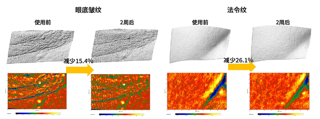Clinical (human application) test result screen confirming the skin wrinkle-improvement effect of a pure retinol 0.1% product, conducted at an Amorepacific lab